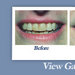 Thumb_gould_teeth_whitening